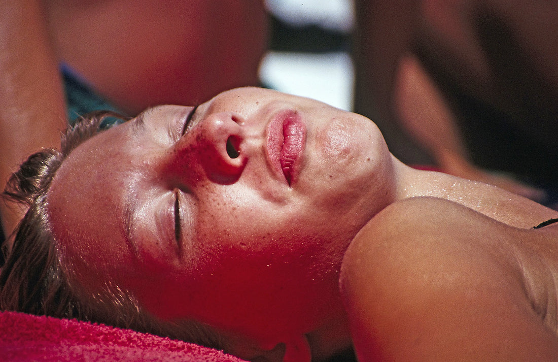 How Aloe Vera Can Help Sunburns